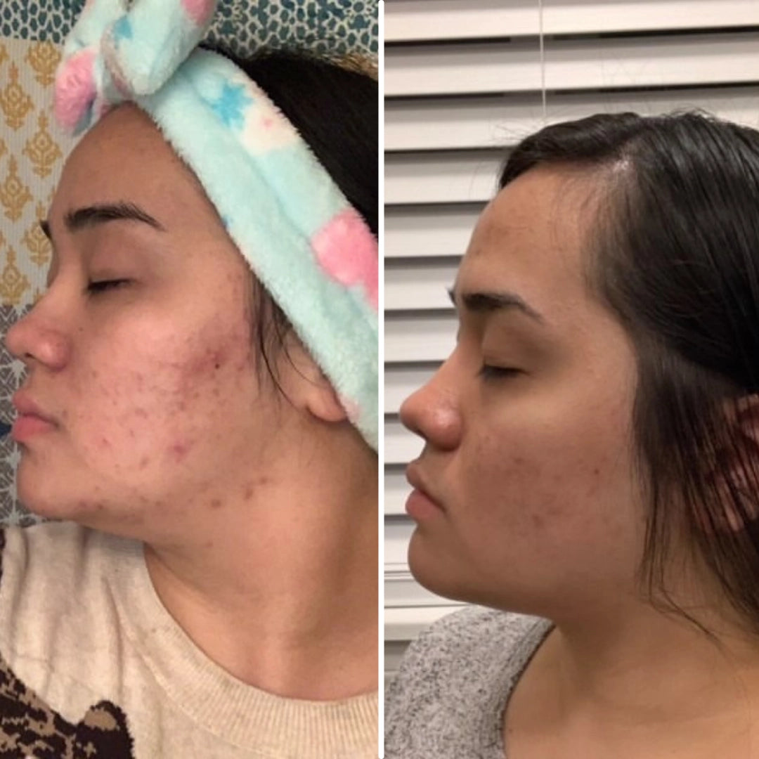 Clean Skin Club 25 count