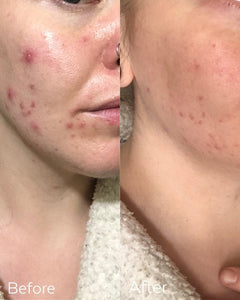 Before and After results from Three Ships Awake Rose Hydrosol Toner